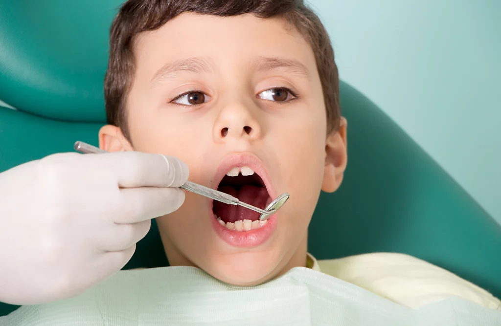 dziecko na fotelu dentystycznym ma przegląd zębów trzonowych