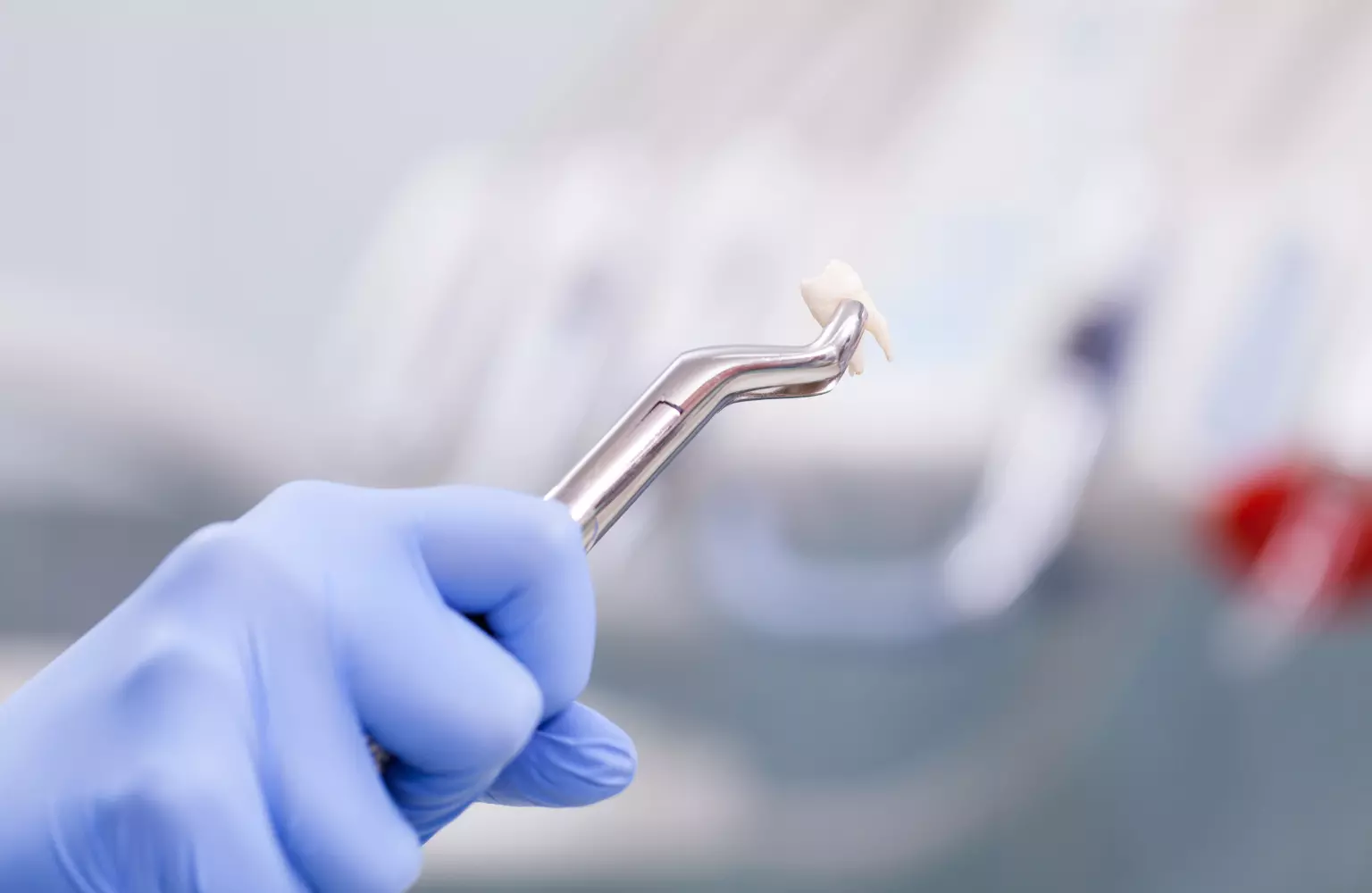 Ekstrakcja zęba - dentysta trzyma wyrwany ząb