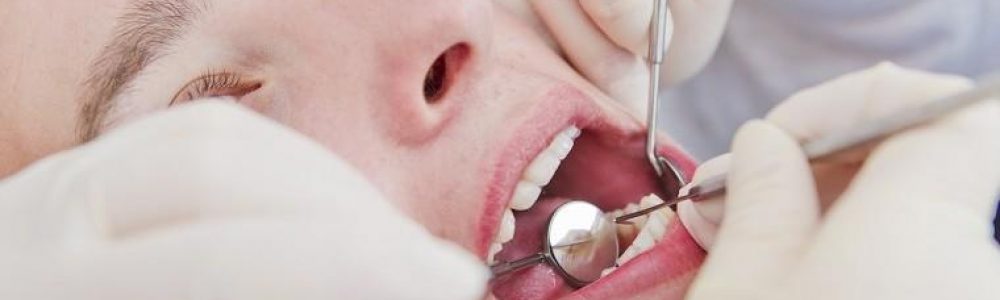 fluoryzacja zębów